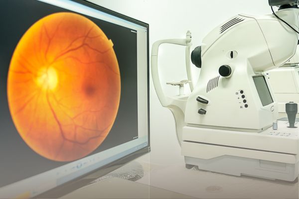 retinografía - Optica La Guarda - Doce Opticos A Guarda
